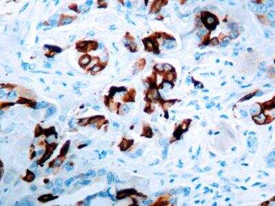 Immunohistochemistry-Paraffin: Mammaglobin A Antibody (EPR9092) [NBP2-41752]