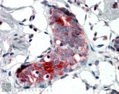 Immunohistochemistry: Mammaglobin A Antibody [NB100-74582]