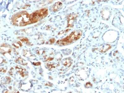 Immunohistochemistry-Paraffin: Mammaglobin A Antibody (MGB/2000) - Azide and BSA Free [NBP2-75729]