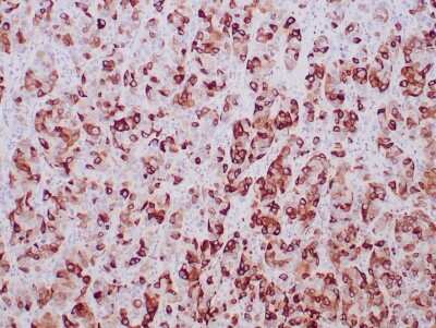 Immunohistochemistry-Paraffin: Mammaglobin A Antibody (MGB/2000) - Azide and BSA Free [NBP2-75729]
