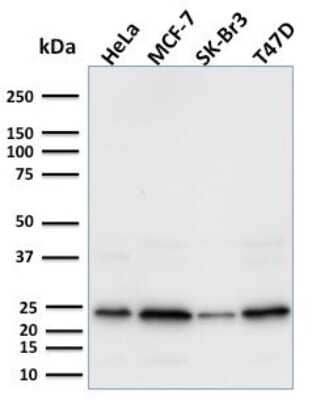 Western Blot: Mammaglobin A Antibody (MGB/2000) [NBP2-75728]