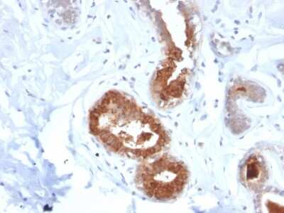 Immunohistochemistry-Paraffin: Mammaglobin A Antibody (MGB/2123R) - Azide and BSA Free [NBP3-08514]