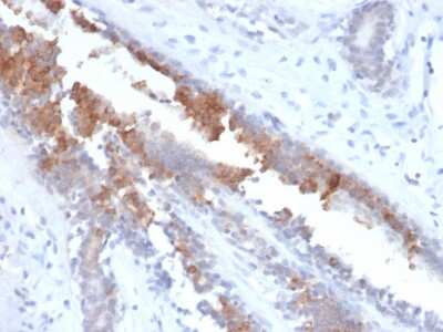 Immunohistochemistry-Paraffin: Mammaglobin A Antibody (MGB/2123R) - Azide and BSA Free [NBP3-08514]