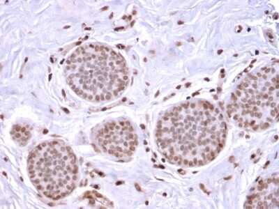 Immunohistochemistry-Paraffin: Mammaglobin A Antibody (MGB/2682R) - Azide and BSA Free [NBP3-08525]