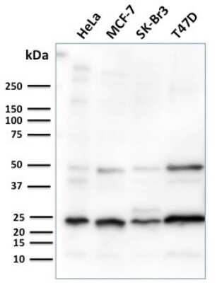 Western Blot: Mammaglobin A Antibody (MGB/2682R)Azide and BSA Free [NBP3-08525]