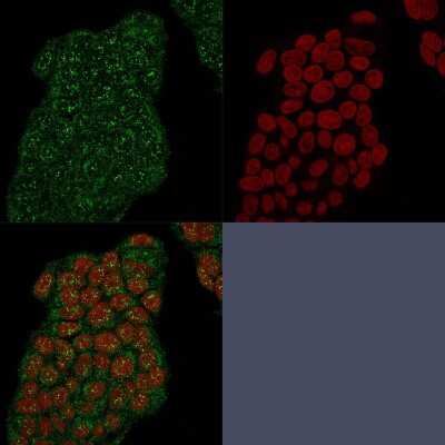 Immunocytochemistry/ Immunofluorescence: Mammaglobin A Antibody (MGB/2682R) [NBP3-07305]