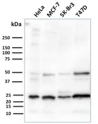 Western Blot: Mammaglobin A Antibody (MGB/2682R) [NBP3-07305]