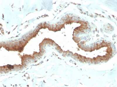 Immunohistochemistry-Paraffin: Mammaglobin A Antibody (MGB/2704) - Azide and BSA Free [NBP3-08429]