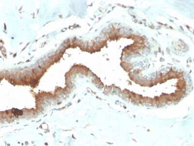 Immunohistochemistry-Paraffin: Mammaglobin A Antibody (MGB/2704) [NBP3-07291]