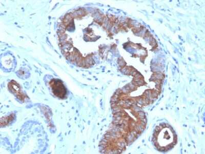 Immunohistochemistry-Paraffin: Mammaglobin A Antibody (MGB/4056) [NBP3-07423]