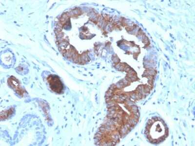 Immunohistochemistry-Paraffin: Mammaglobin A Antibody (MGB/4056) - Azide and BSA Free [NBP3-08641]