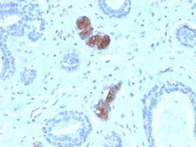 Immunohistochemistry-Paraffin: Mammaglobin A Antibody (MGB/4056) - Azide and BSA Free [NBP3-08641]
