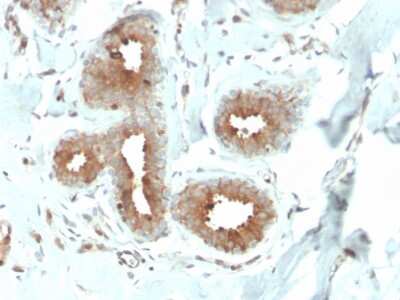 Immunohistochemistry-Paraffin: Mammaglobin A Antibody (MGB/4057R) [NBP3-07306]