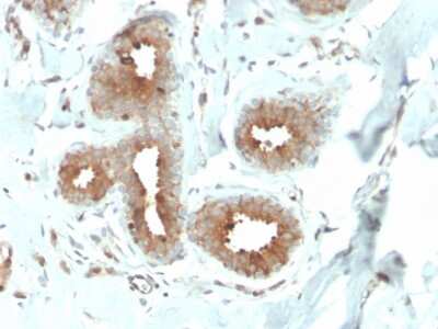 Immunohistochemistry-Paraffin: Mammaglobin A Antibody (MGB/4057R) - Azide and BSA Free [NBP3-08526]