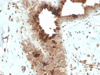Immunohistochemistry-Paraffin: Mammaglobin A Antibody (MGB/4057R) - Azide and BSA Free [NBP3-08526]