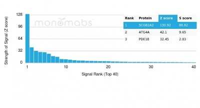 Protein Array: Mammaglobin A Antibody (MGB/4057R) [NBP3-07306]