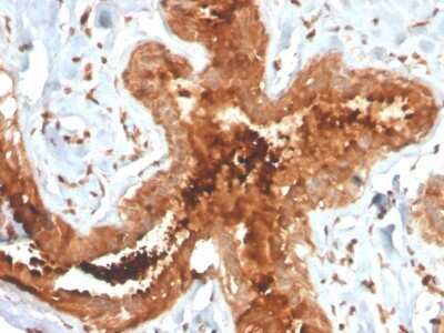 Immunohistochemistry-Paraffin: Mammaglobin A Antibody (MGB/4058R) - Azide and BSA Free [NBP3-08586]