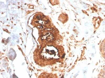 Immunohistochemistry-Paraffin: Mammaglobin A Antibody (MGB/4058R) [NBP3-07314]