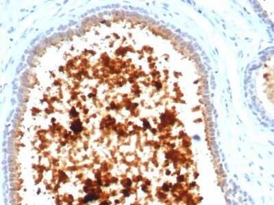 Immunohistochemistry-Paraffin: Mammaglobin A Antibody (MGB/4811R) - Azide and BSA Free [NBP3-08488]