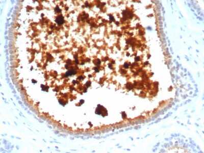 Immunohistochemistry-Paraffin: Mammaglobin A Antibody (MGB/4811R) - Azide and BSA Free [NBP3-08488]