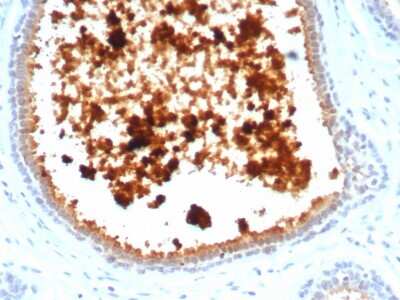 Immunohistochemistry-Paraffin: Mammaglobin A Antibody (MGB/4811R) [NBP3-07300]