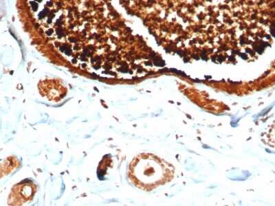 Immunohistochemistry-Paraffin: Mammaglobin A Antibody (MGB/4812R) - Azide and BSA Free [NBP3-08489]