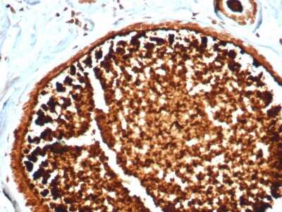 Immunohistochemistry-Paraffin: Mammaglobin A Antibody (MGB/4812R) - Azide and BSA Free [NBP3-08489]