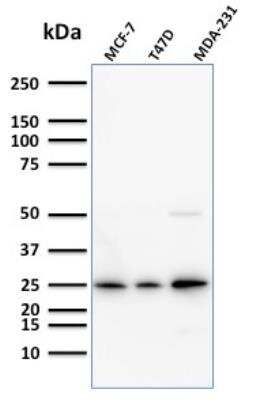 Western Blot: Mammaglobin A Antibody (SPM518)Azide and BSA Free [NBP2-79864]