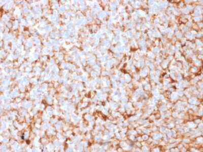 Immunohistochemistry-Paraffin: Mammaglobin A Antibody (SPM518) [NBP2-79729]