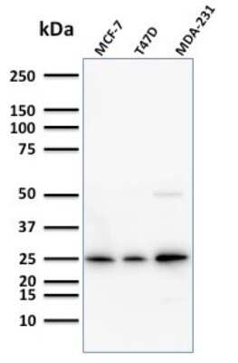 Western Blot: Mammaglobin A Antibody (SPM518) [NBP2-79729]