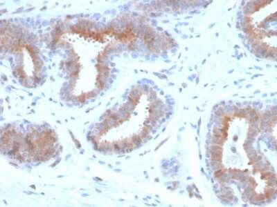 Immunohistochemistry-Paraffin: Mammaglobin A Antibody (rMGB/4299) - Azide and BSA Free [NBP3-08472]