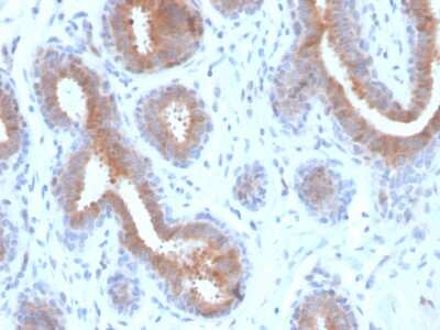 Immunohistochemistry-Paraffin: Mammaglobin A Antibody (rMGB/4299) - Azide and BSA Free [NBP3-08472]