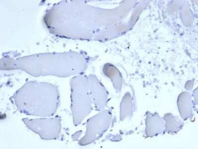 Immunohistochemistry-Paraffin: Mammaglobin A Antibody (rMGB/6619) - Azide and BSA Free [NBP3-08428]