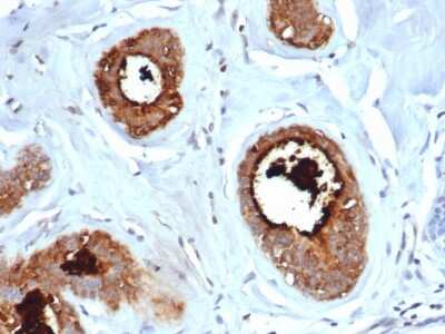 Immunohistochemistry-Paraffin: Mammaglobin A Antibody (rMGB/6619) [NBP3-07290]