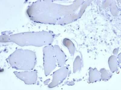 Immunohistochemistry-Paraffin: Mammaglobin A Antibody (rMGB/6619) [NBP3-07290]