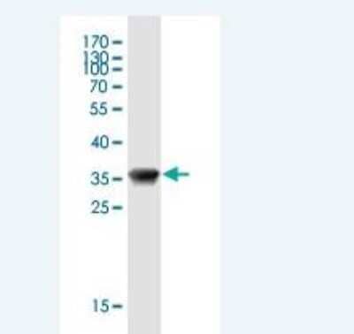 Western Blot: Mammaglobin B Antibody (1G10) [H00004246-M01]