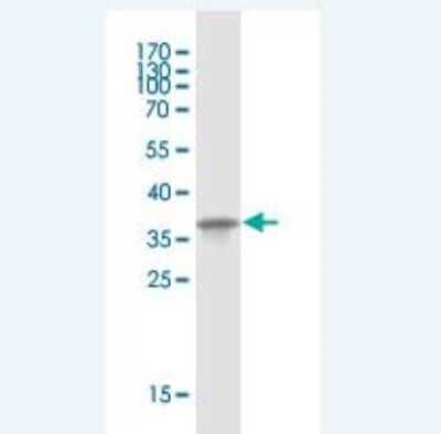 Western Blot: Mammaglobin B Antibody (2E2) [H00004246-M07]