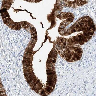 Immunohistochemistry-Paraffin: Mammaglobin B Antibody [NBP1-87736]