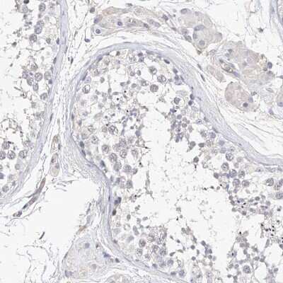 Immunohistochemistry-Paraffin: Mammaglobin B Antibody [NBP1-87736]