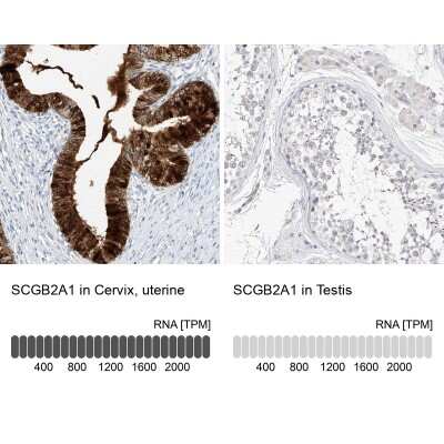 Immunohistochemistry-Paraffin: Mammaglobin B Antibody [NBP1-87736]