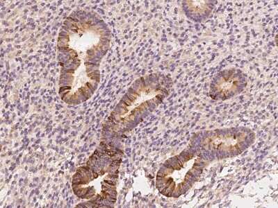 Immunohistochemistry-Paraffin: Mammaglobin B Antibody [NBP2-97784]