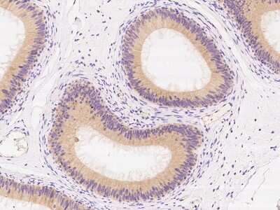 Immunohistochemistry-Paraffin: Mammaglobin B Antibody [NBP2-97784]