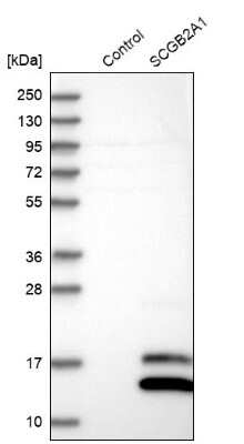 Western Blot: Mammaglobin B Antibody [NBP1-87736]