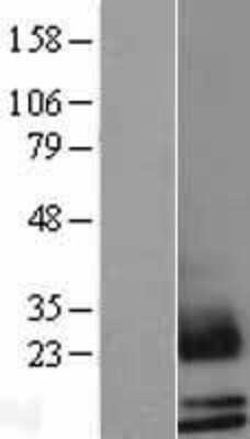 Western Blot: Mammaglobin B Overexpression Lysate [NBL1-15734]