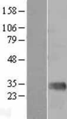 Western Blot: MBL Overexpression Lysate [NBL1-12927]