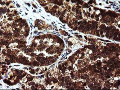 Immunohistochemistry-Paraffin: Mannose Phosphate Isomerase Antibody (OTI1C7) [NBP2-02043]