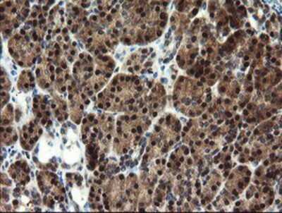 Immunohistochemistry-Paraffin: Mannose Phosphate Isomerase Antibody (OTI1C7) [NBP2-02043]
