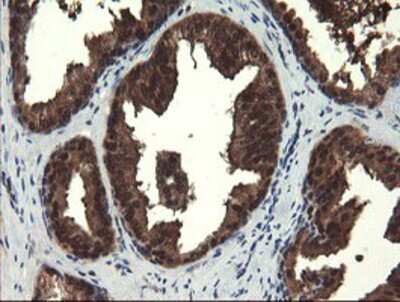 Immunohistochemistry-Paraffin: Mannose Phosphate Isomerase Antibody (OTI1C7) [NBP2-02043]