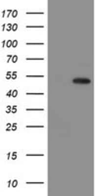 Western Blot: Mannose Phosphate Isomerase Antibody (OTI1C7) [NBP2-02043]