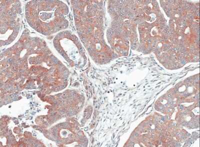 Immunohistochemistry-Paraffin: Mannose Phosphate Isomerase Antibody [NBP1-31460]